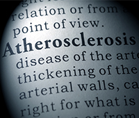 Atherosclerosis Causes