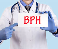 Enlarged prostate or Benign Prostatic Hyperplasia -BPH- Symptoms