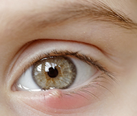 Sty - Eyelid cyst Symptoms