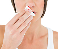 Nose bleed Symptoms