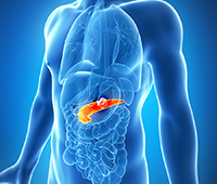 Pancreatitis Causes