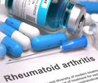 Rheumatoid arthritis Causes
