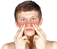 Symptoms Of Sinusitis Infections