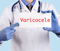 Varicocele Diagnosis