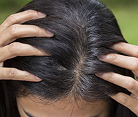 What is Premature greying Ayurvedic treatment